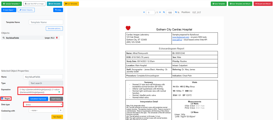 Set Expression and Data Type